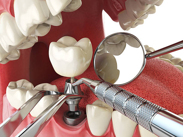 Best Knocked-Out Tooth Emergency  in Carrollton, OH